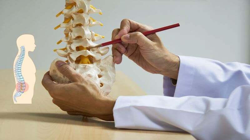 Bel Kayması Ameliyatı Kimlere Gerekir? Uzmanlardan Cerrahi Endikasyonlar